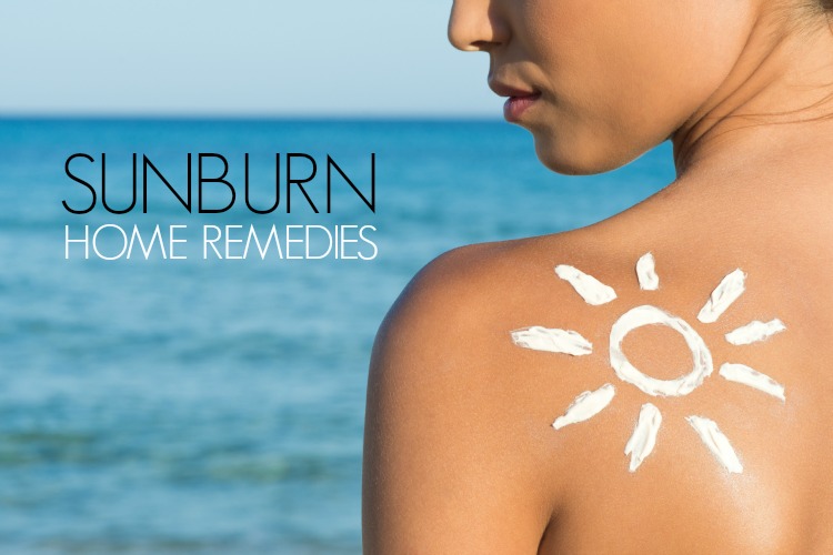 Home remedies for sunburn treatment