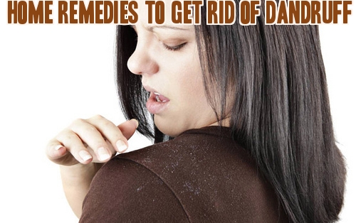 How To Get Rid Of Dandruff?; Home Remedies For Dandruff