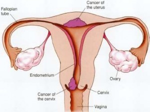 cervical cancer symptoms
