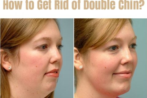 Remedies to Get Rid of Double Chin Fast