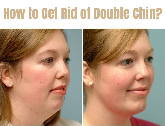 How to Get Rid of Double Chin? Exercises and Remedies to Remove Double Chin Fast
