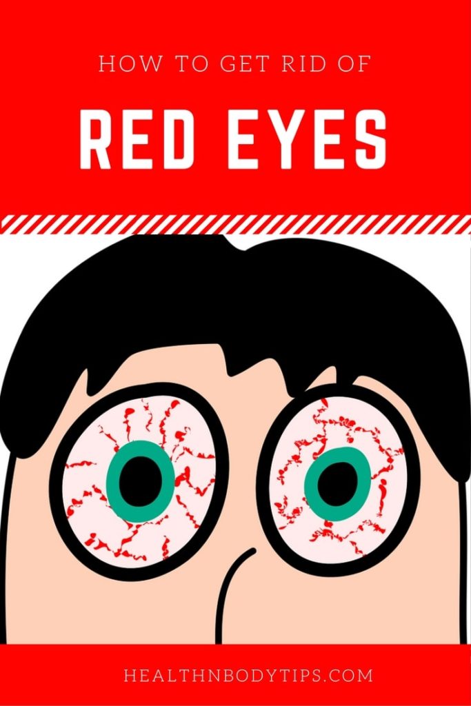 how-to-get-rid-of-red-eyes-10-home-remedies-for-bloodshot-eyes