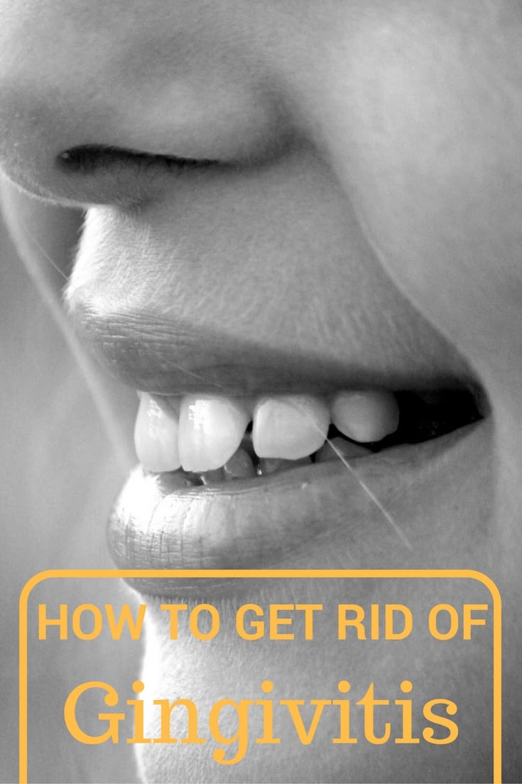 How to Get Rid of Gingivitis?