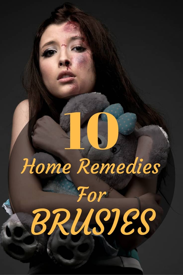 How To Get Rid of Bruises?