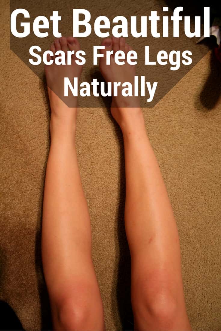 How to Get Rid Of Scars on Legs?