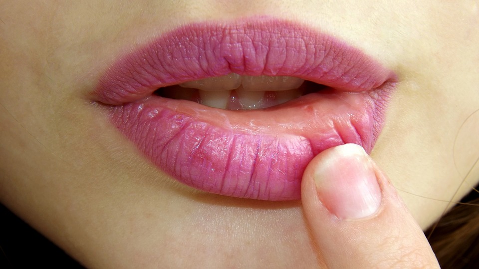 Get Rid of Chapped Lips