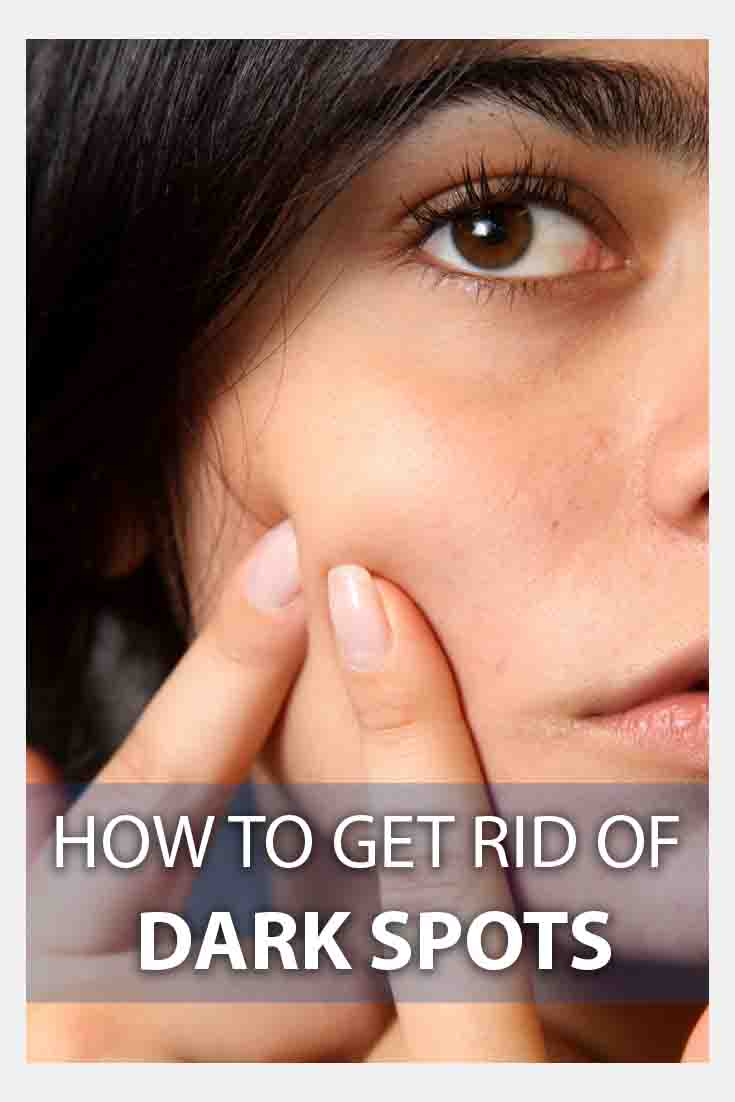 How to Get Rid of Dark Spots on Skin?