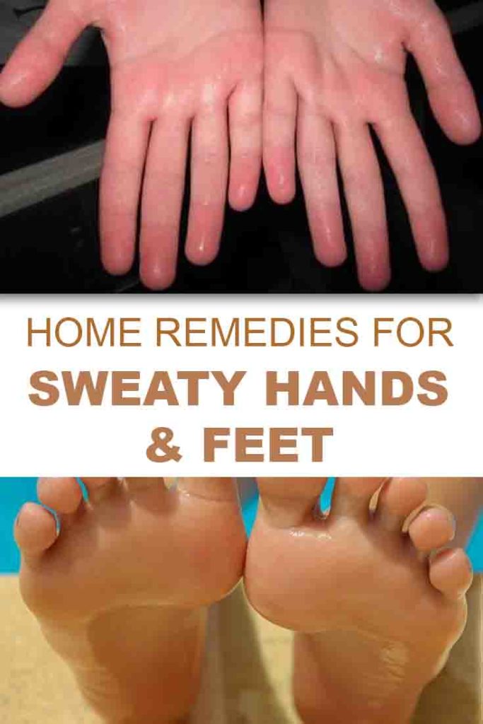 What Condition Causes Sweaty Hands And Feet