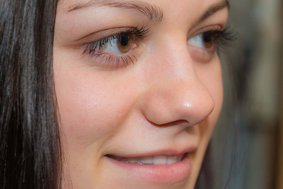 How to Get Rid of Bags Under Eyes Fast? Top 8 Natural Remedies