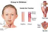 Home remedies for croup