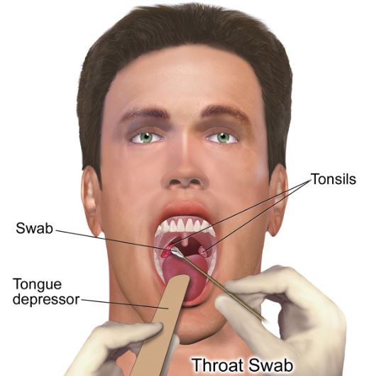 How to Get Rid of Tonsillitis? 6 Easy Home Remedies for Tonsillitis