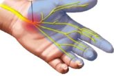 Home remedies for carpal tunnel