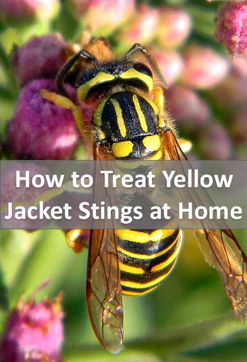 Home remedies for Yellow Jacket Stings