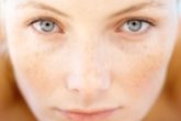 How to get rid of broken capillaries on face