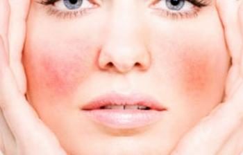 How to get rid of redness on face