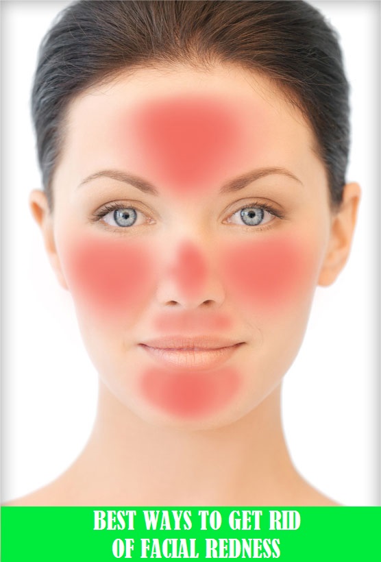 How to get rid of redness on face