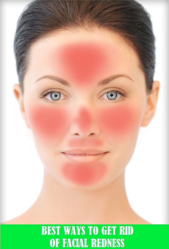 natural-tips-to-get-rid-of-facial-redness-how-to-cure-red-irritated