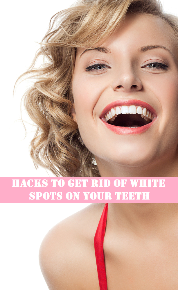 How to get rid of white spots on your teeth 