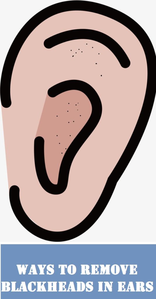 How to get rid of blackheads in ears