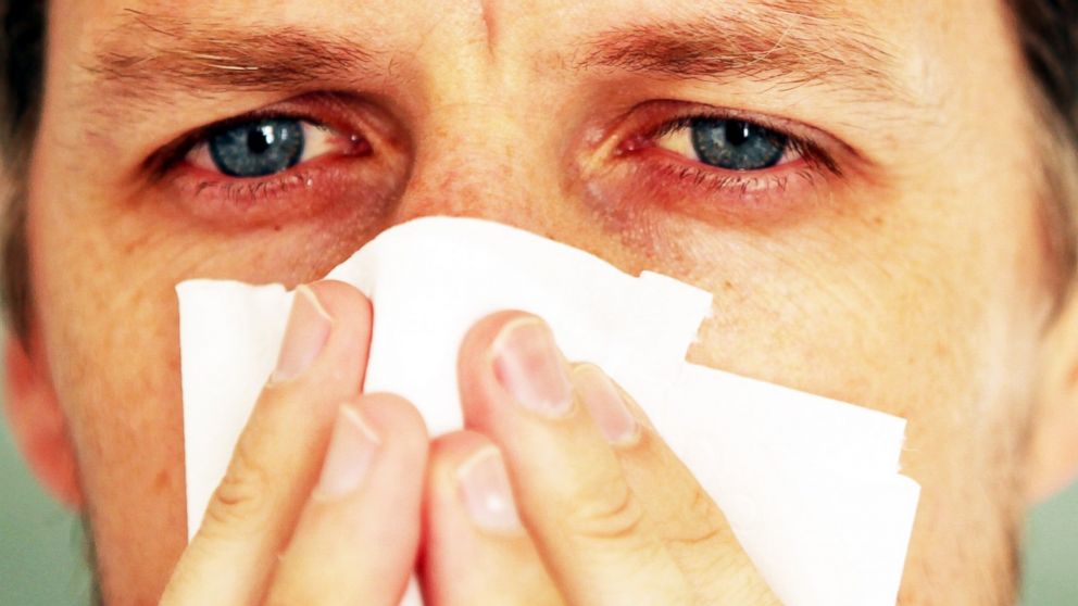 How to get rid of mold allergies