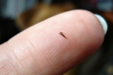 How to get rid of a splinter