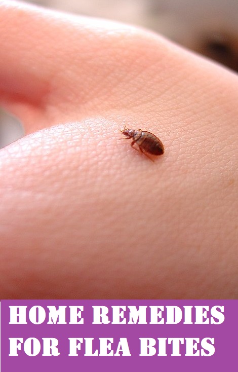 How to treat flea bites in humans